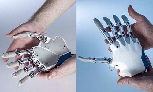 瑞士发明新型仿生学假肢 可让病人拥有